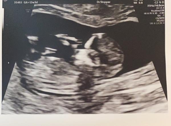 Bild zu Baby Tv 🥰 - Schwanger - wer noch? Rund um die Schwangerschaft