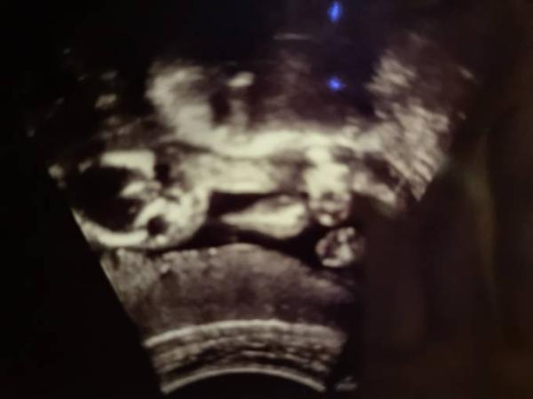 Bild zu Mädchen oder Junge? - Schwanger - wer noch? Rund um die Schwangerschaft