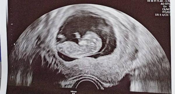 Bild zu Nub Theorie - Schwanger - wer noch? Rund um die Schwangerschaft