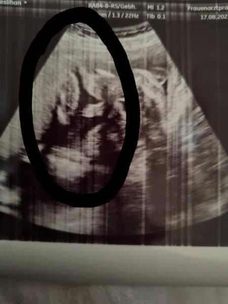 Bild zu Junge, oder? 😍🥳💙 - Schwanger - wer noch? Rund um die Schwangerschaft
