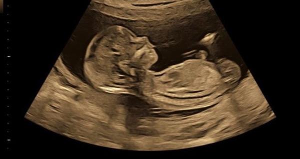 Bild zu Junge oder Mädchen? - Schwanger - wer noch? Rund um die Schwangerschaft