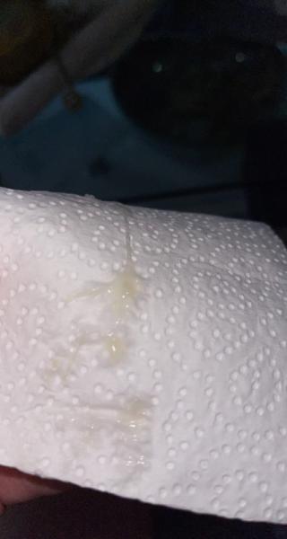 Bild zu Ist das Ausfluss oder der Schleimpropf? - Schwanger - wer noch? Rund um die Schwangerschaft
