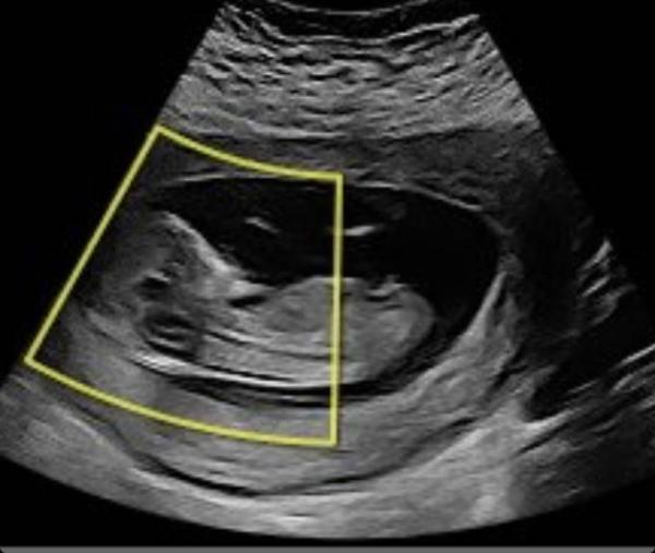 Bild zu Geschlecht - Schwanger - wer noch? Rund um die Schwangerschaft