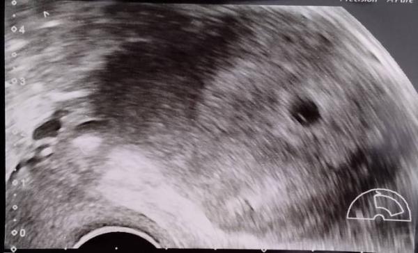 Bild zu US Bild - Schwanger - wer noch? Rund um die Schwangerschaft