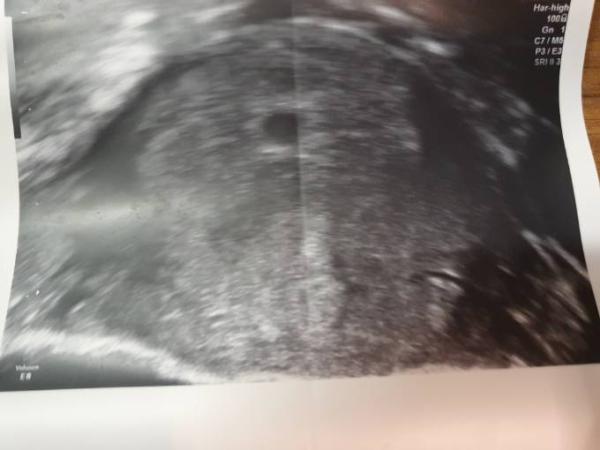 Bild zu Ultraschallbild - Schwanger - wer noch? Rund um die Schwangerschaft