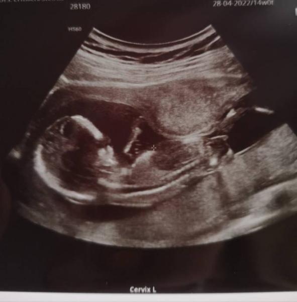 Bild zu 15 SSW Madi oder Bub? :) - Schwanger - wer noch? Rund um die Schwangerschaft