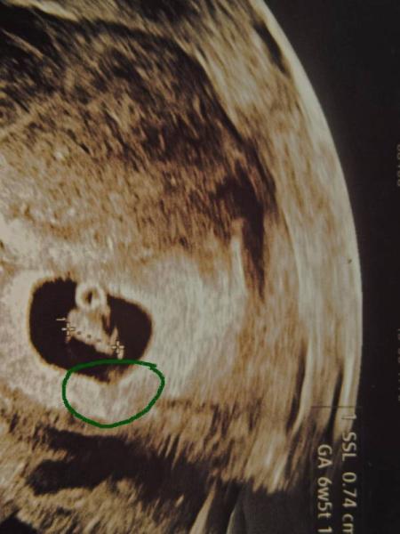 Bild zu Was ist das? - Schwanger - wer noch? Rund um die Schwangerschaft