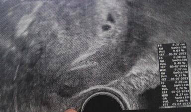 Bild zu Fehlgeburt oder doch nicht - Schwanger - wer noch? Rund um die Schwangerschaft