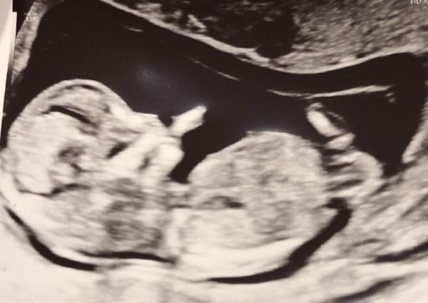 Bild zu Junge oder mädchen? - Schwanger - wer noch? Rund um die Schwangerschaft