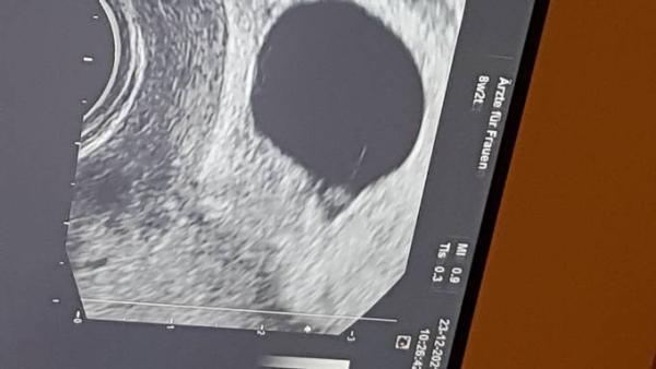Bild zu Zurück Datiert - Schwanger - wer noch? Rund um die Schwangerschaft
