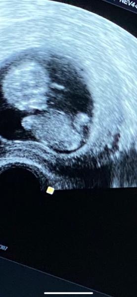Bild zu Nub Theorie - Schwanger - wer noch? Rund um die Schwangerschaft