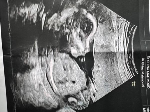 Bild zu Geschlecht xx xy - Schwanger - wer noch? Rund um die Schwangerschaft