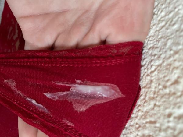 Bild zu Ist dies ein typischer SS Ausfluss? ACHTUNG Bild! - Schwanger - wer noch? Rund um die Schwangerschaft