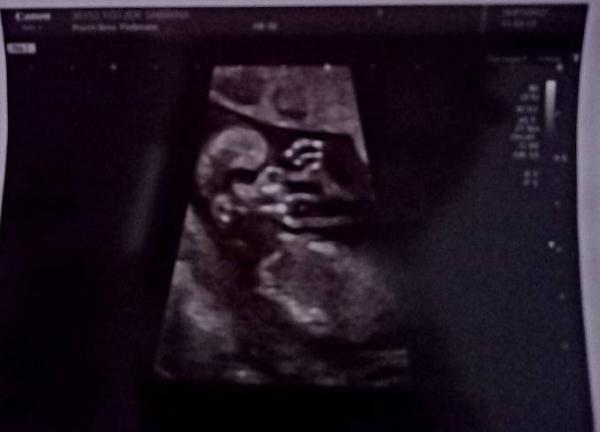 Bild zu Baby macht Winke Winke - Schwanger - wer noch? Rund um die Schwangerschaft