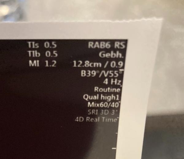Bild zu Ultraschallbild - Schwanger - wer noch? Rund um die Schwangerschaft