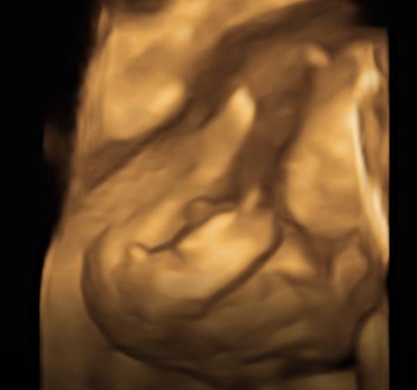 Bild zu Mädchen oder Junge? - Schwanger - wer noch? Rund um die Schwangerschaft