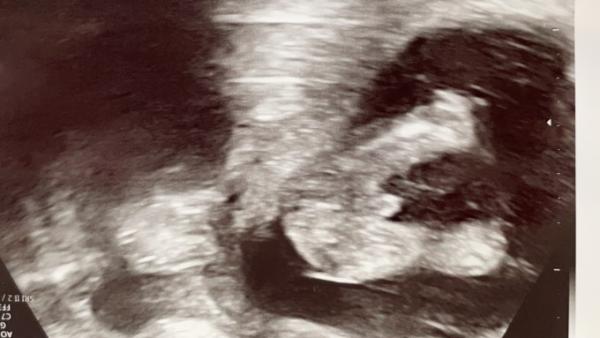 Bild zu Junge oder Mädchen? - Schwanger - wer noch? Rund um die Schwangerschaft
