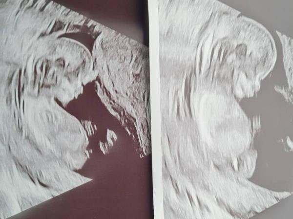 Bild zu Junge oder Mädchen ????? - Schwanger - wer noch? Rund um die Schwangerschaft