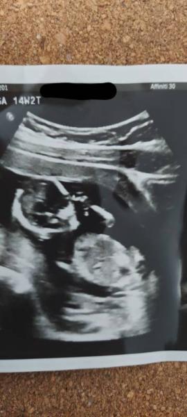 Bild zu Junge oder Mädchen? - Schwanger - wer noch? Rund um die Schwangerschaft