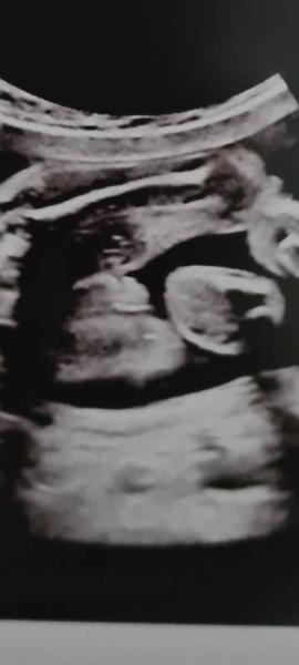 Bild zu Junge oder Mädchen?? - Schwanger - wer noch? Rund um die Schwangerschaft