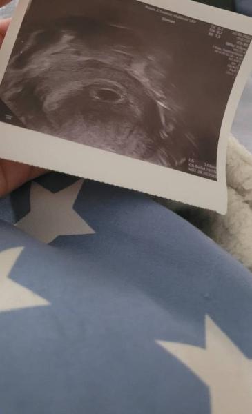 Bild zu 6+2 Hilfe - Schwanger - wer noch? Rund um die Schwangerschaft