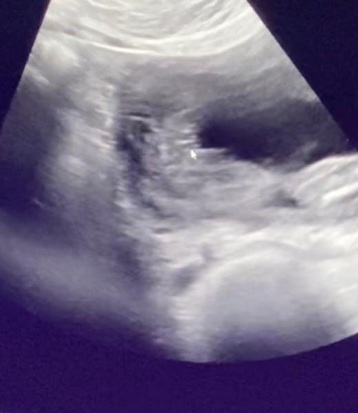 Bild zu Girl or boy - Schwanger - wer noch? Rund um die Schwangerschaft