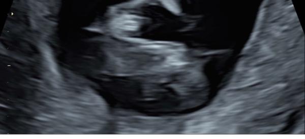 Bild zu Geschlecht? 😱 - Schwanger - wer noch? Rund um die Schwangerschaft
