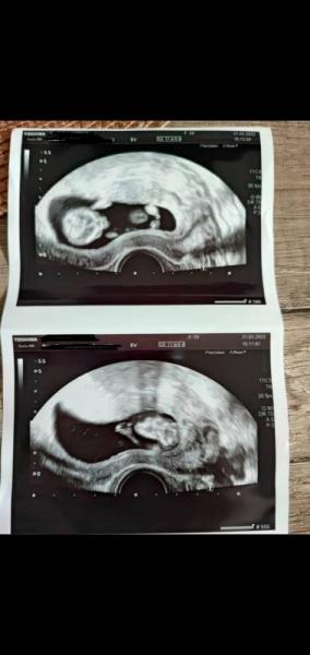 Bild zu Junge oder Mädchen - Schwanger - wer noch? Rund um die Schwangerschaft