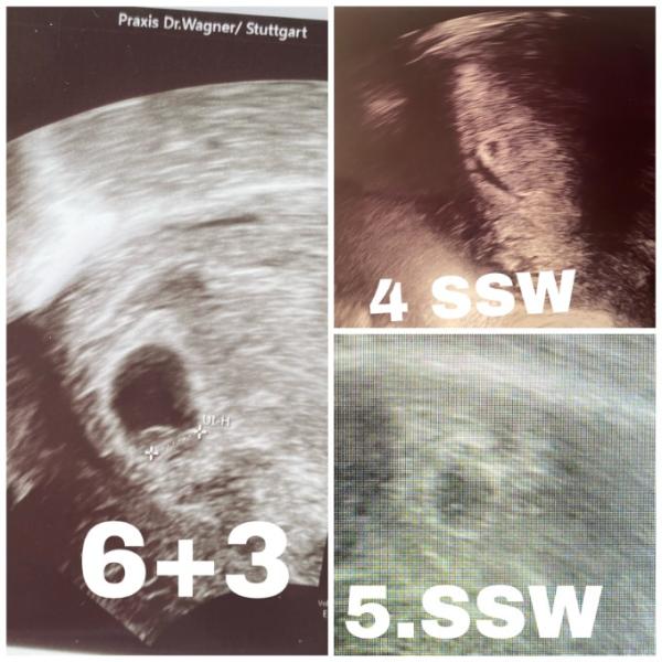 Bild zu Ultraschallfotos - Schwanger - wer noch? Rund um die Schwangerschaft
