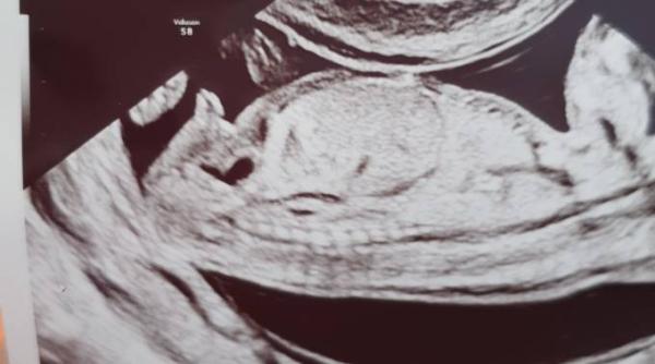 Bild zu Nub Theorie - Schwanger - wer noch? Rund um die Schwangerschaft