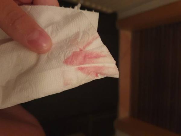 Bild zu Hell Rosa Schmierblutung 9ssw - Schwanger - wer noch? Rund um die Schwangerschaft