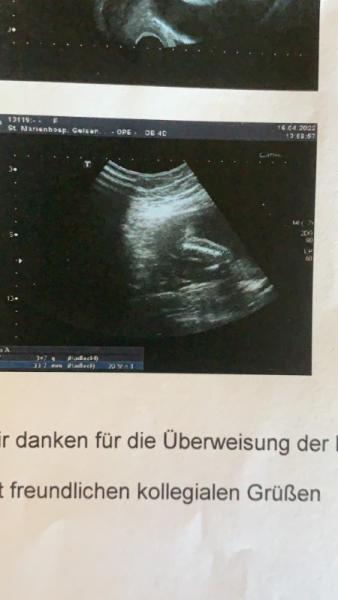 Bild zu Arzt macht mir angst und junge oder mädchen - Schwanger - wer noch? Rund um die Schwangerschaft