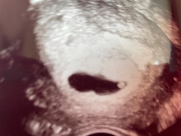 Bild zu Erster Termin beim FA - Schwanger - wer noch? Rund um die Schwangerschaft