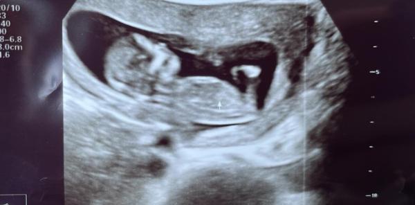 Bild zu Junge oder Mädchen? - Schwanger - wer noch? Rund um die Schwangerschaft