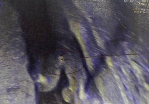 Bild zu Geschlecht - Schwanger - wer noch? Rund um die Schwangerschaft