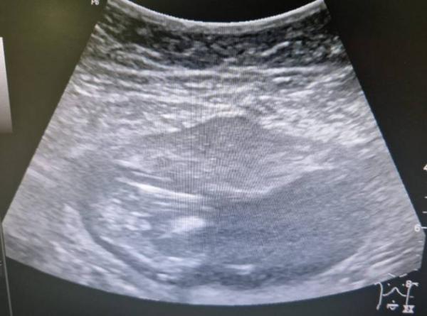 Bild zu Neugierig hoch 10 - Geschlecht? - Schwanger - wer noch? Rund um die Schwangerschaft