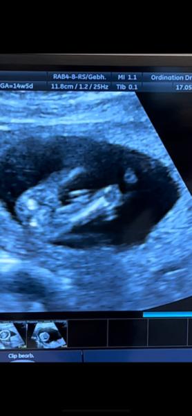 Bild zu Geschlecht? - Schwanger - wer noch? Rund um die Schwangerschaft