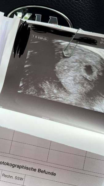 Bild zu Fruchthöhle - Schwanger - wer noch? Rund um die Schwangerschaft