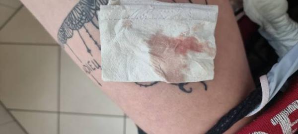 Bild zu Ss test positiv 5+2 blutung - Schwanger - wer noch? Rund um die Schwangerschaft