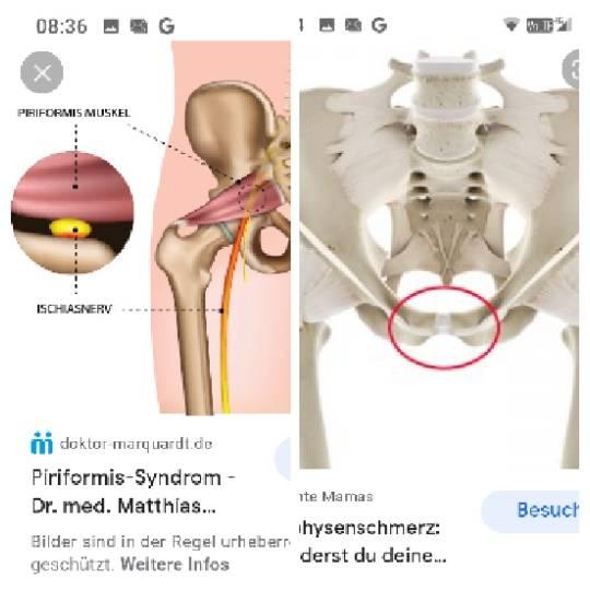 Bild zu Unterschied Ischias, Piriformis und Symphyse? - Schwanger - wer noch? Rund um die Schwangerschaft