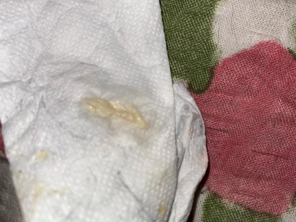 Bild zu Ist das der Schleimpropf? Vorsicht Bild ! - Schwanger - wer noch? Rund um die Schwangerschaft