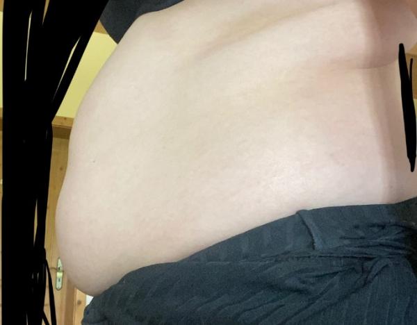 Bild zu Schwangerschafts oder Fettbauch? - Schwanger - wer noch? Rund um die Schwangerschaft