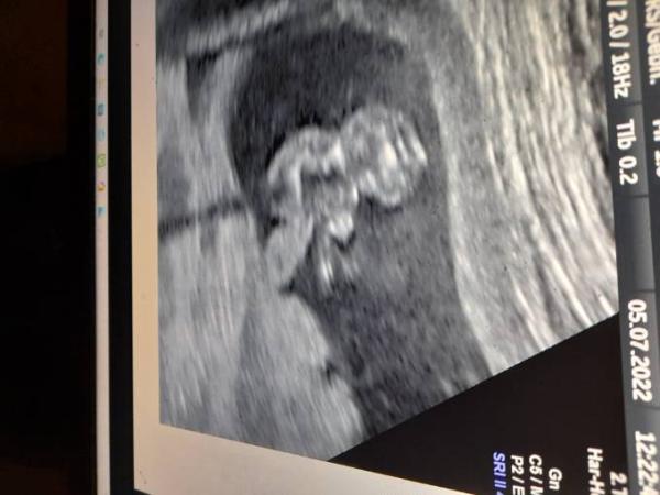 Bild zu Liegt meine Frauenärztin richtig ? :) - Schwanger - wer noch? Rund um die Schwangerschaft