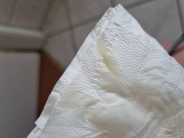 Bild zu Schleimpfropf? ACHTUNG BILD - Schwanger - wer noch? Rund um die Schwangerschaft