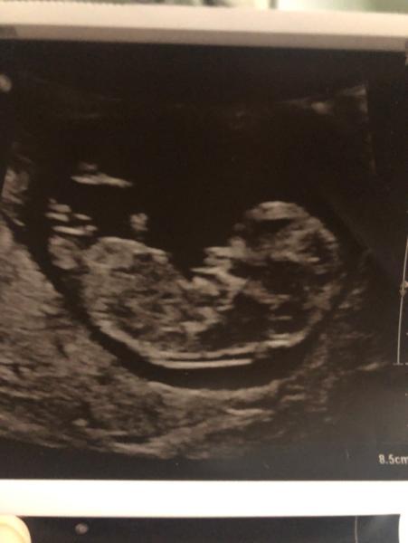 Bild zu Mädchen oder junge ?😍 - Schwanger - wer noch? Rund um die Schwangerschaft