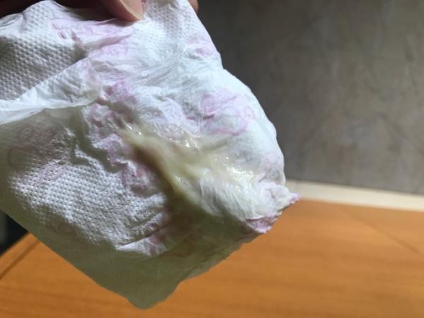 Bild zu Ist das der Schleimpfropf? - Schwanger - wer noch? Rund um die Schwangerschaft