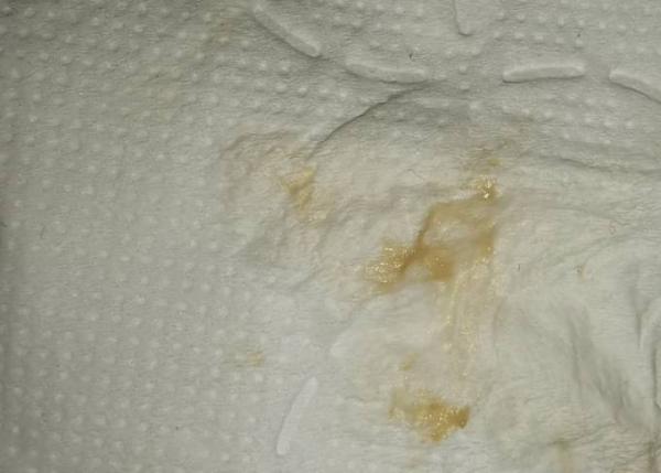 Bild zu Komischer Ausfluss normal? - Schwanger - wer noch? Rund um die Schwangerschaft