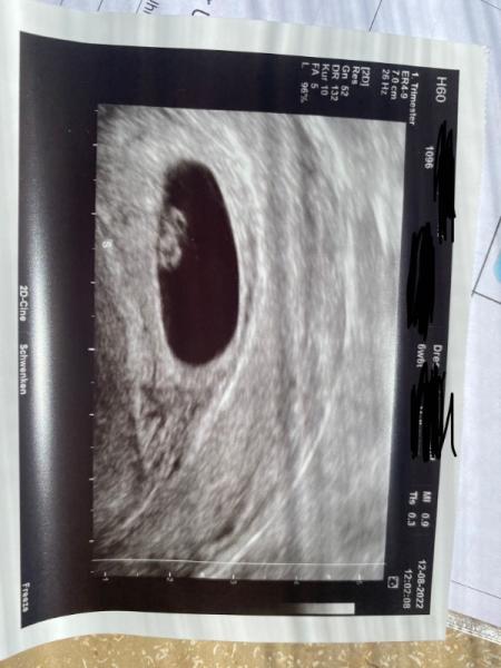 Bild zu Endlich Klarheit, Schwanger 🤰 - Schwanger - wer noch? Rund um die Schwangerschaft