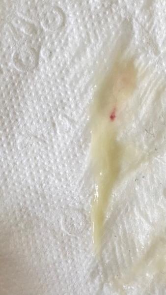 Bild zu ACHTUNG FOTO! Ausfluss - Schwanger - wer noch? Rund um die Schwangerschaft
