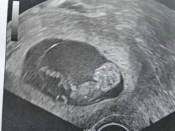 Bild zu Nub Theorie - Schwanger - wer noch? Rund um die Schwangerschaft
